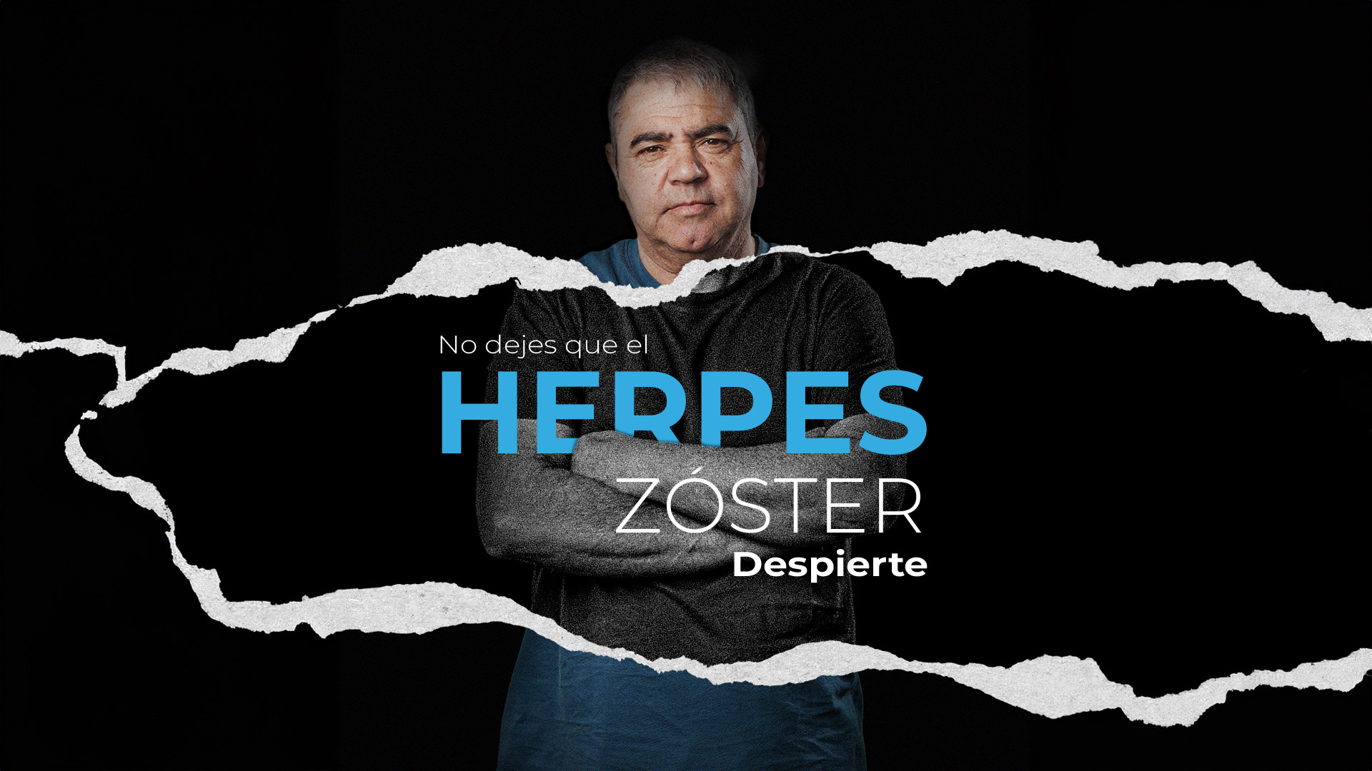 Herpes Zóster al Descubierto: Desenmascarando algunos Mitos